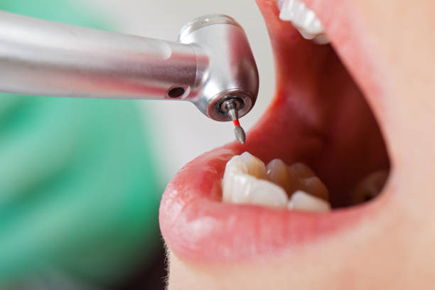 Best Emergency Dental Care for Broken or Chipped Teeth in Trinity, NC